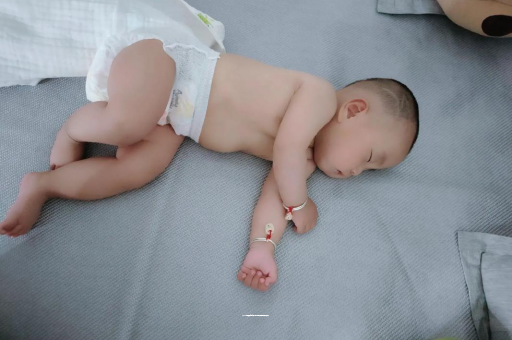 仙桃宝宝头上长痱子